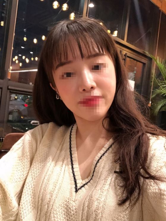 수술후기이미지