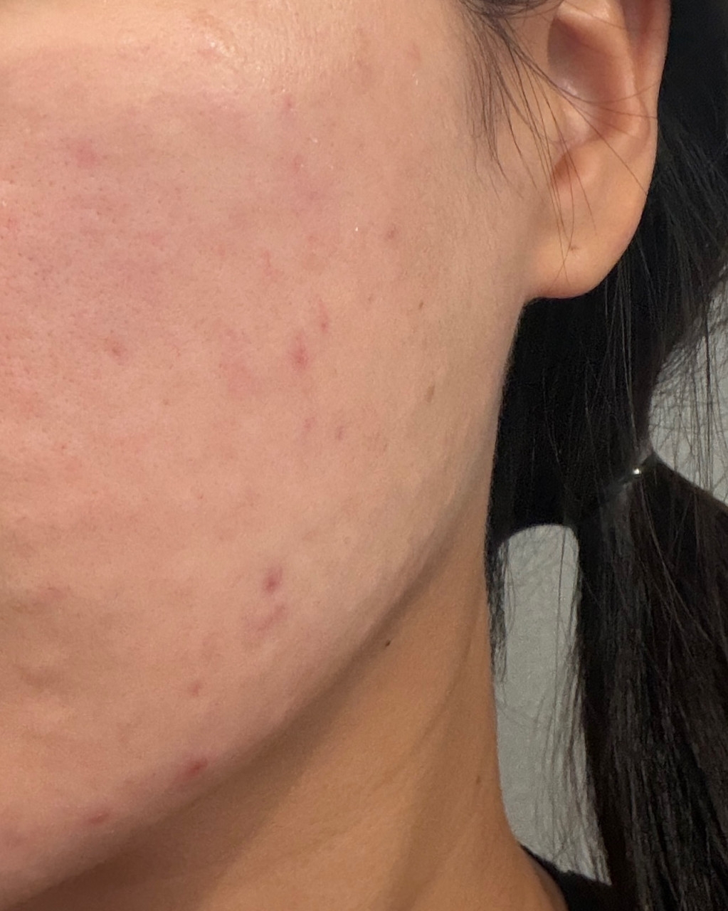 수술후기이미지