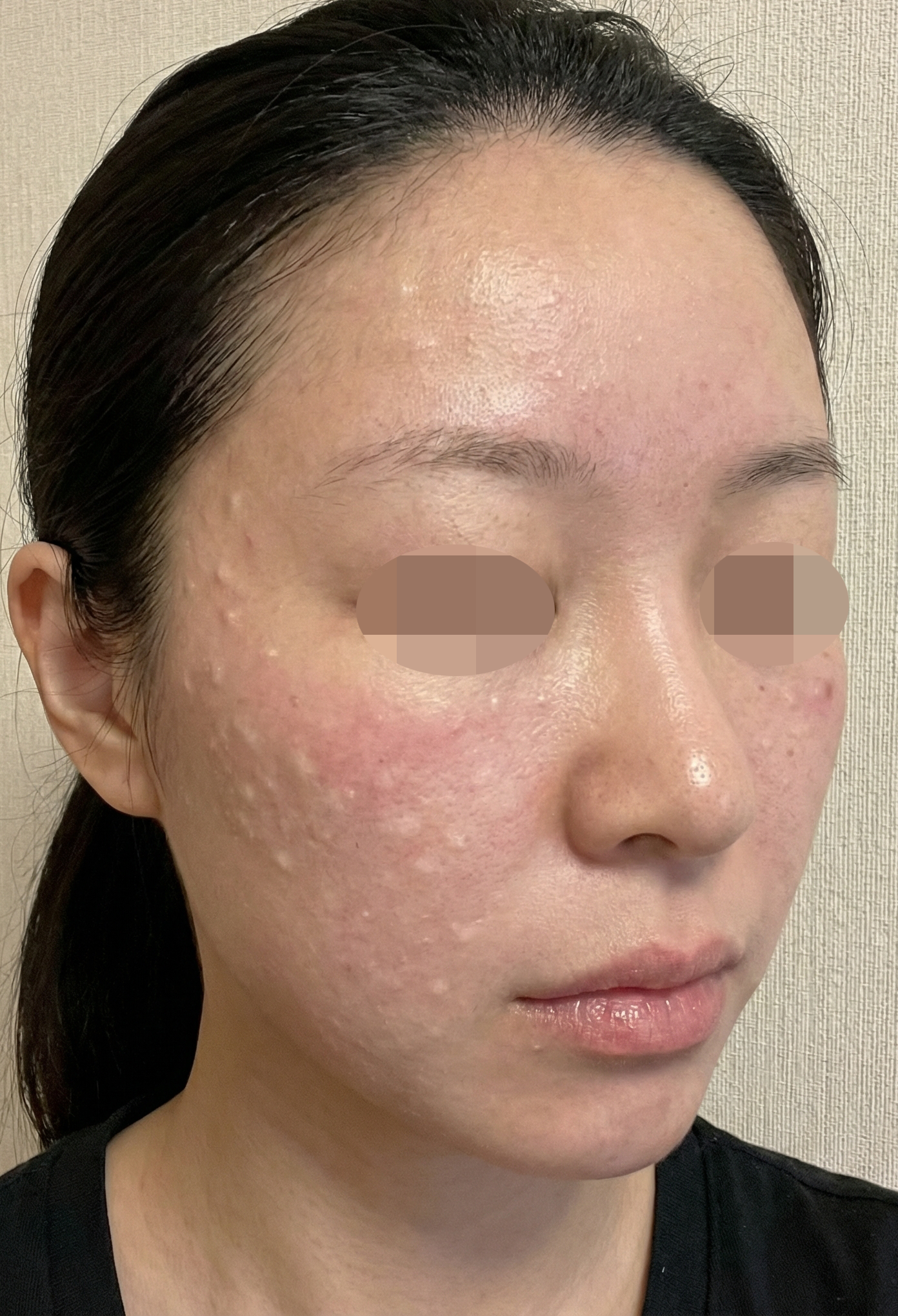 수술후기이미지