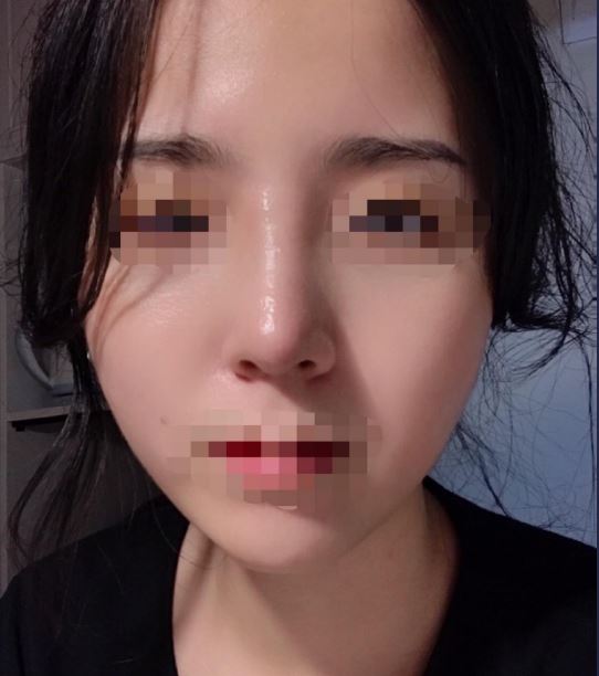 수술후기이미지