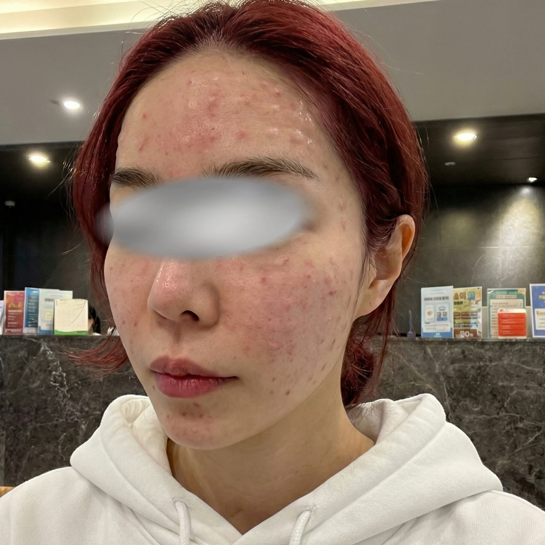 수술후기이미지