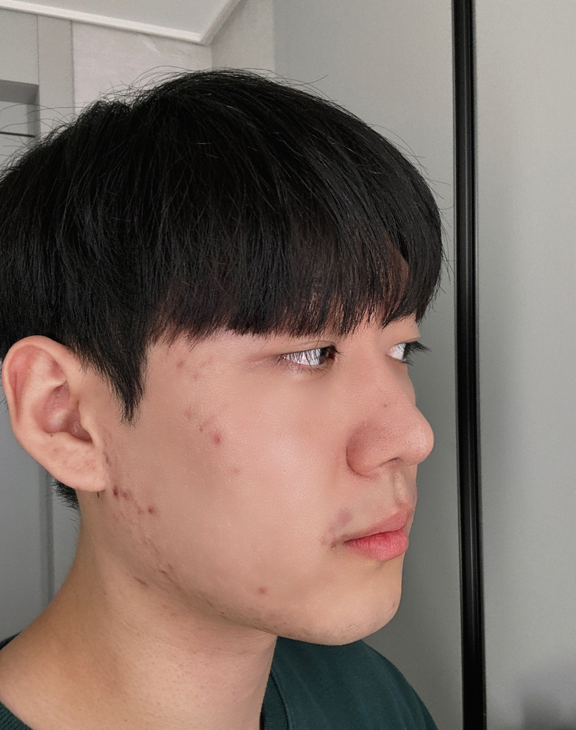 수술후기이미지