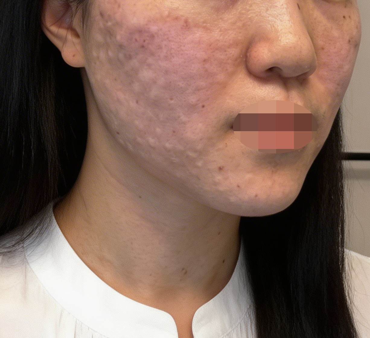 수술후기이미지