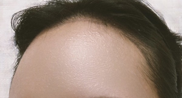 수술후기이미지