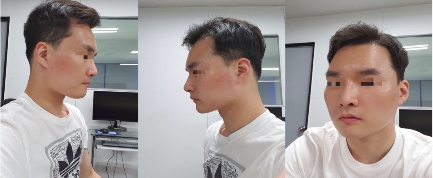 수술후기이미지