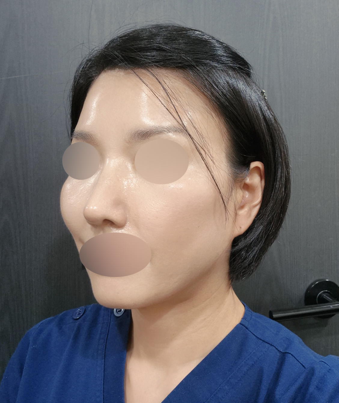 수술후기이미지