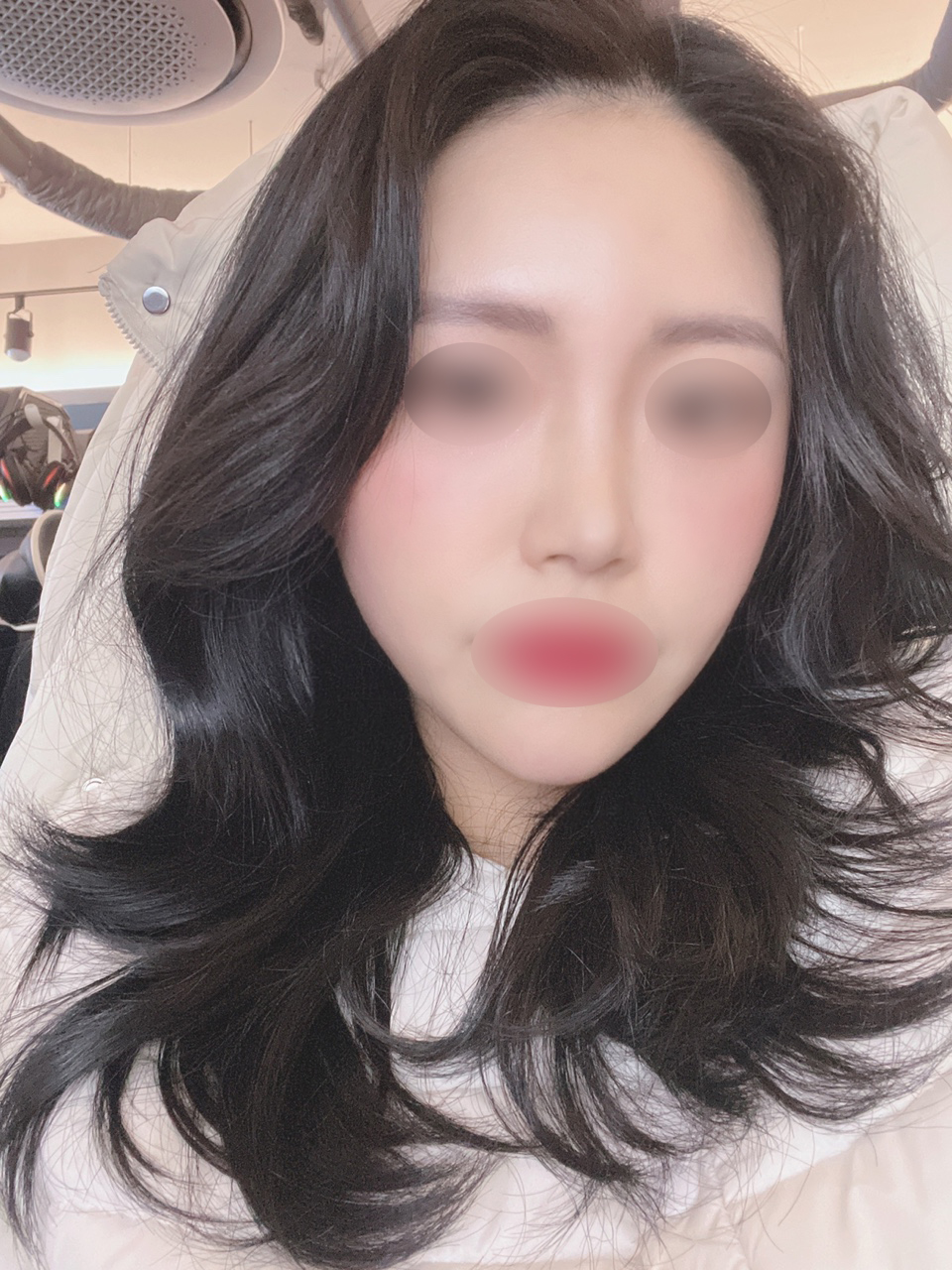 수술후기이미지