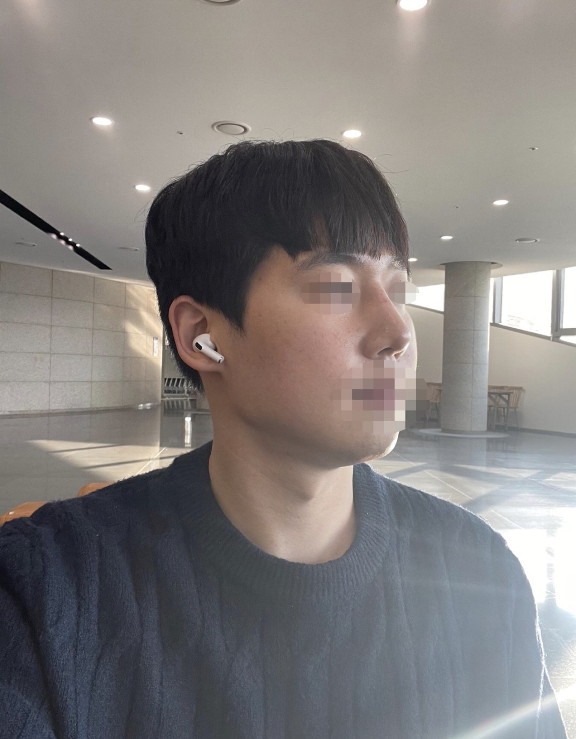 수술후기이미지