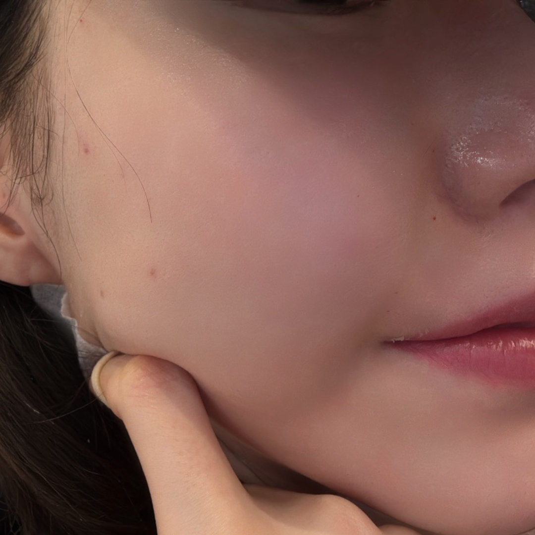 수술후기이미지