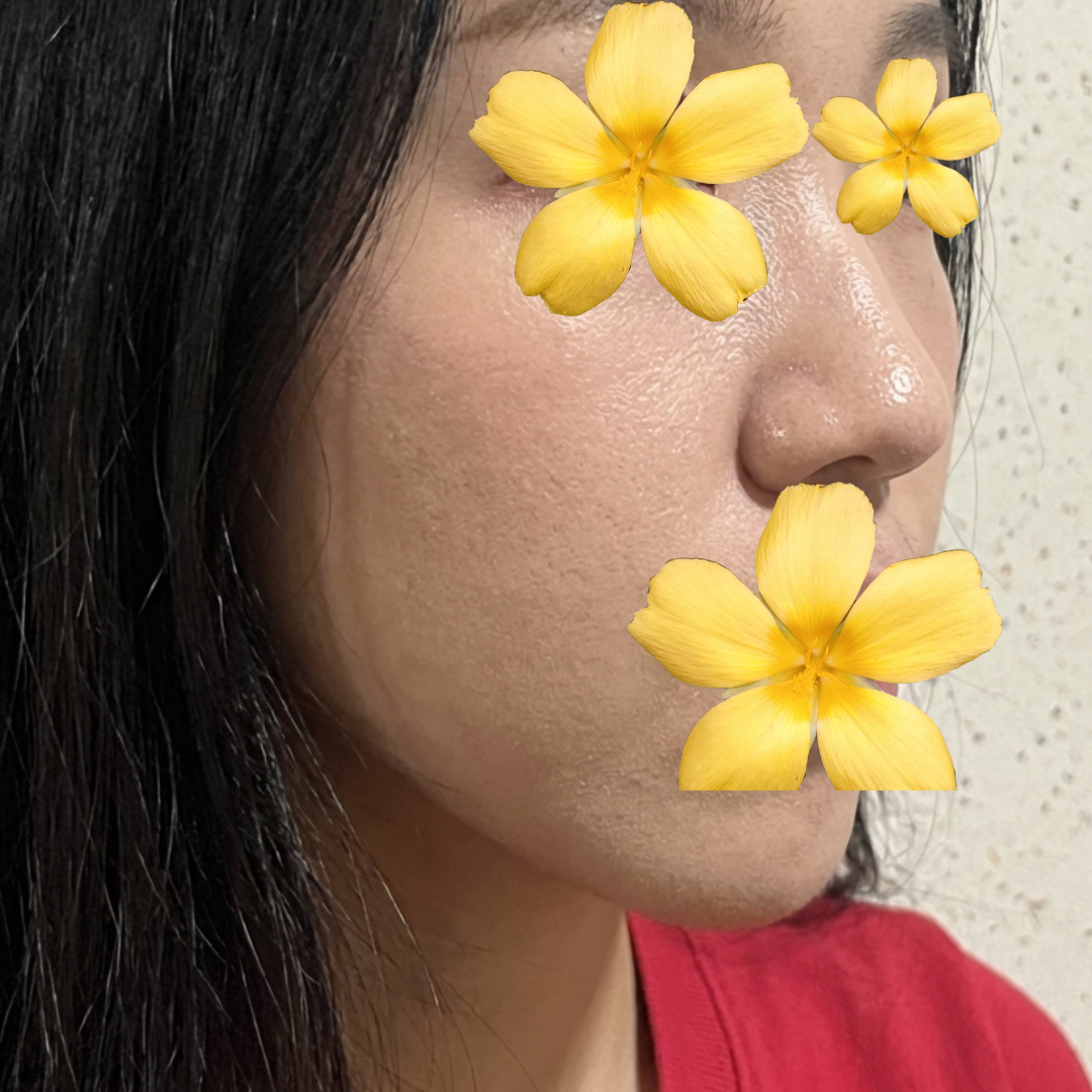 수술후기이미지