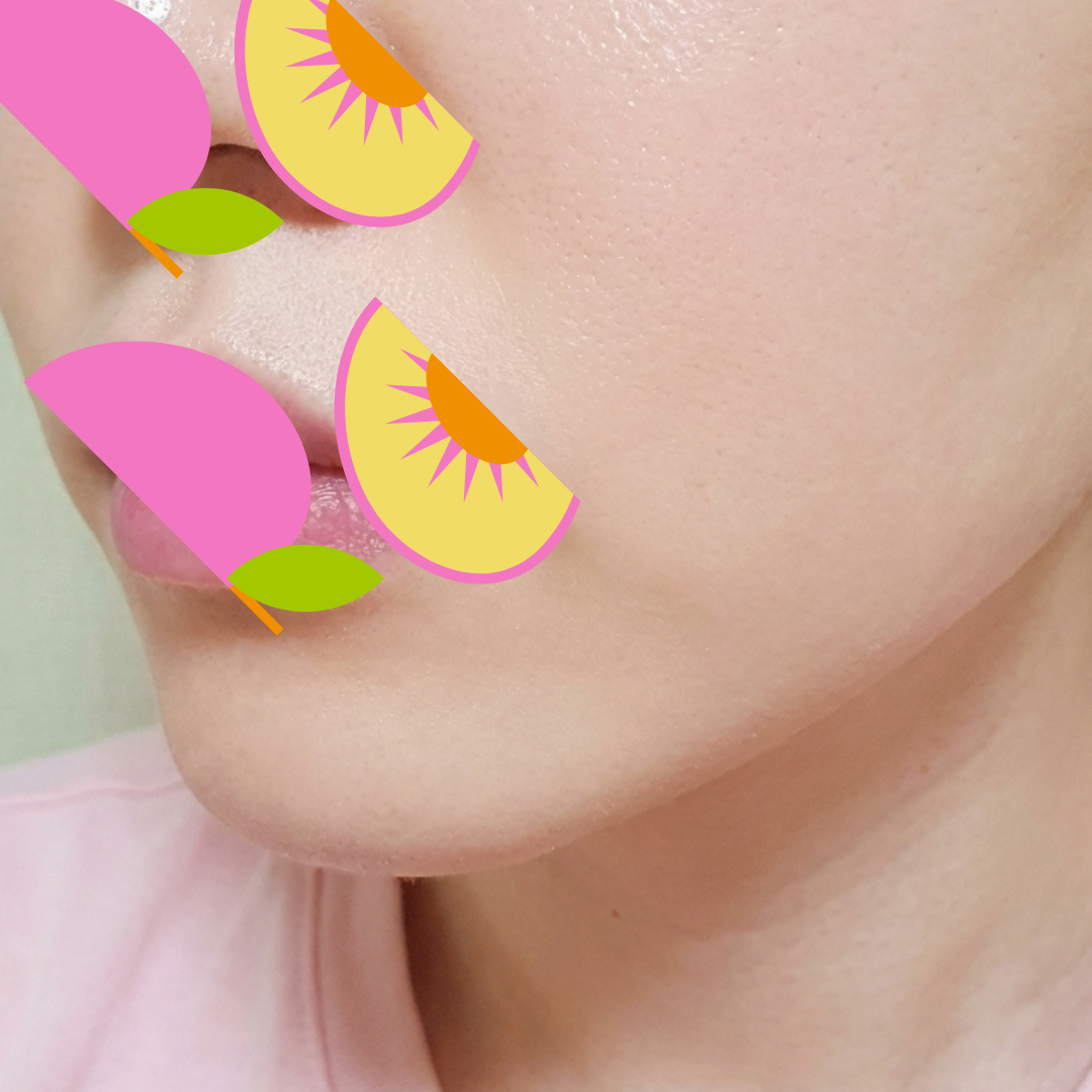 수술후기이미지