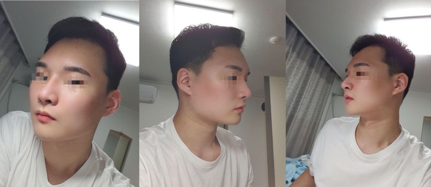 수술후기이미지