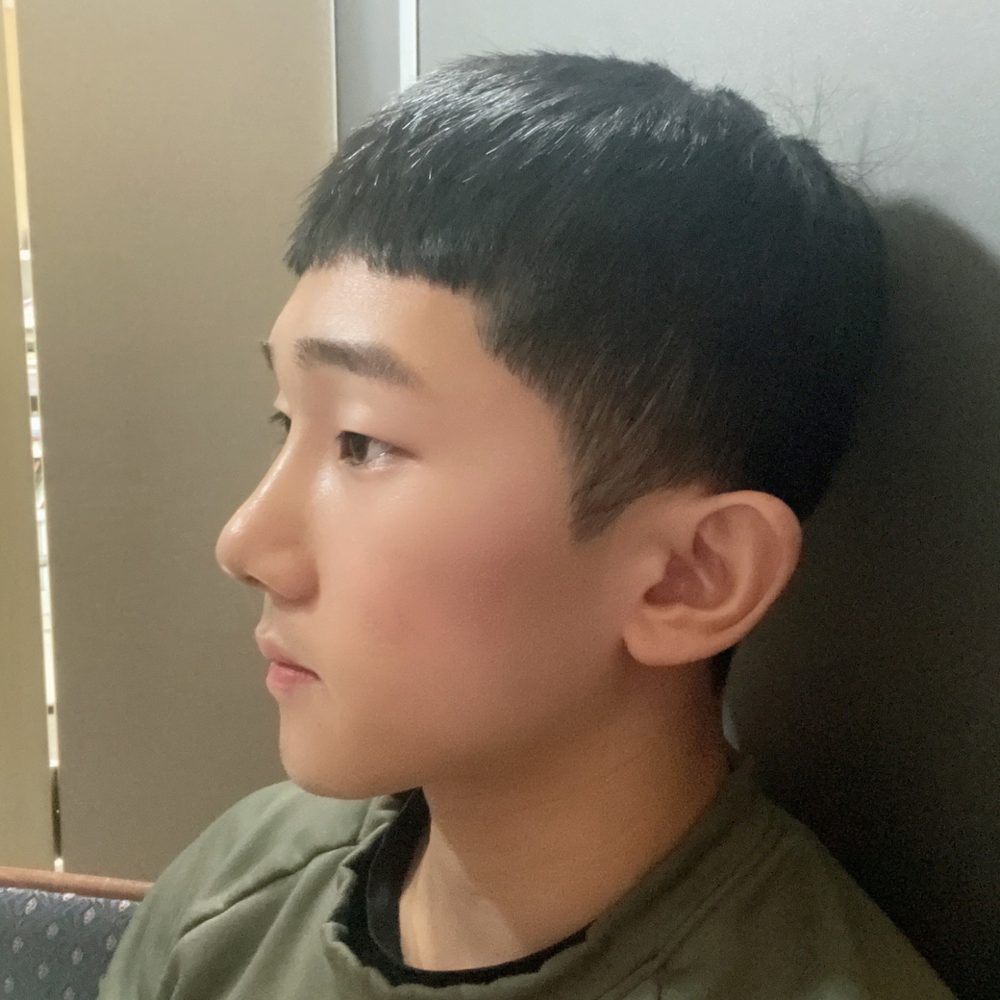 수술후기이미지