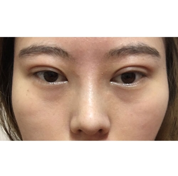 수술후기이미지