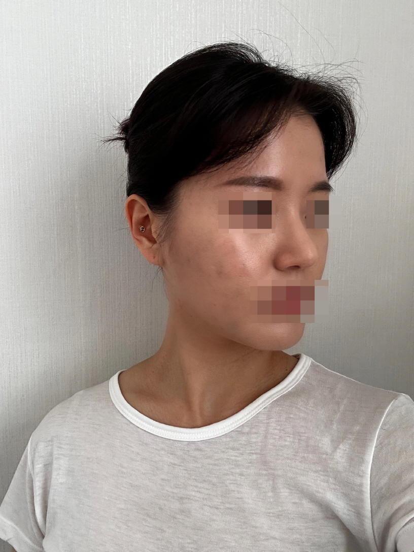 수술후기이미지