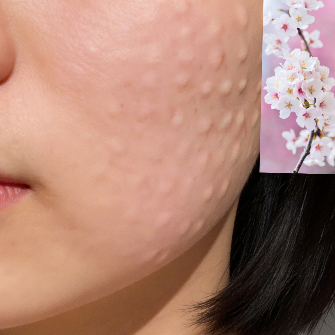 수술후기이미지