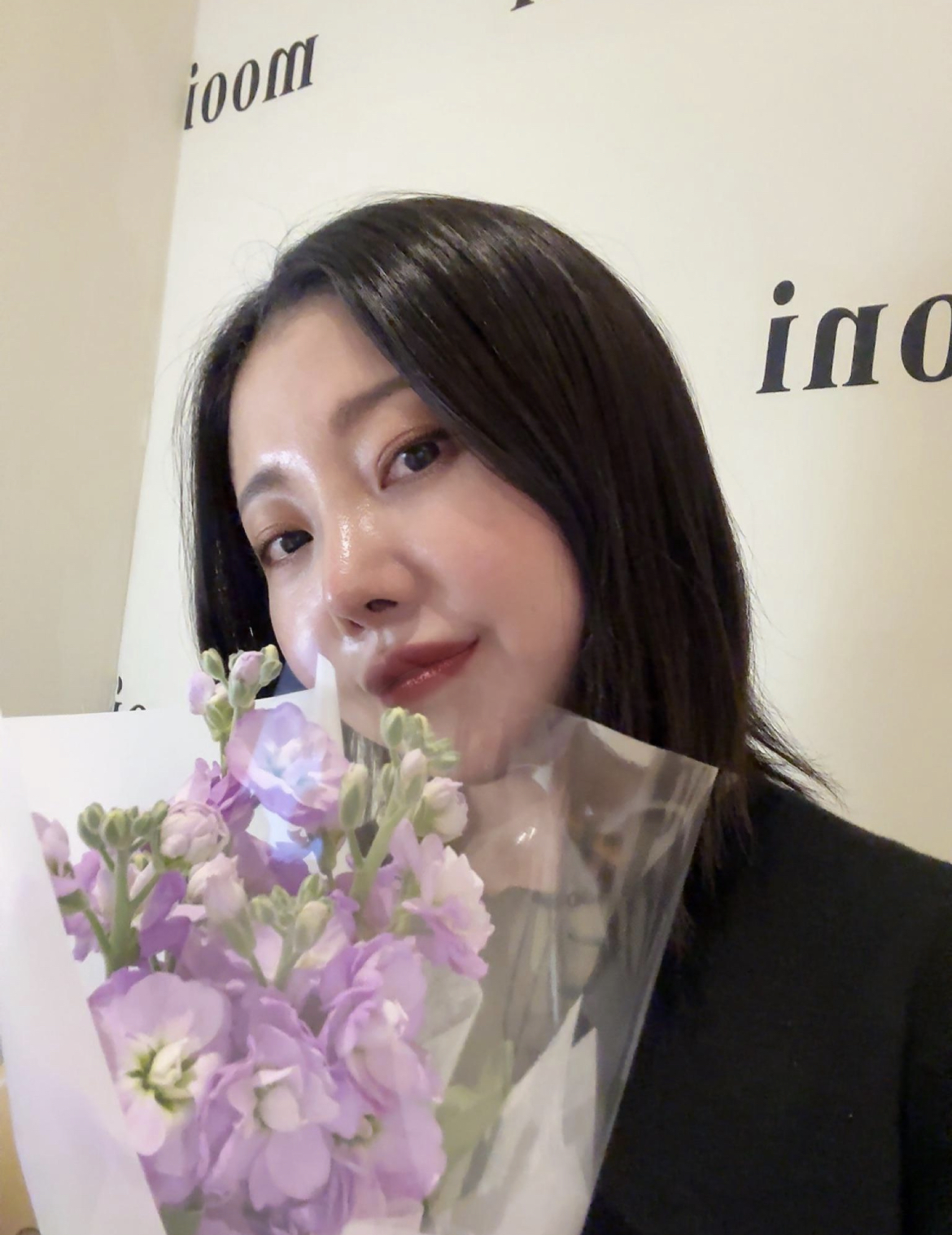 수술후기이미지