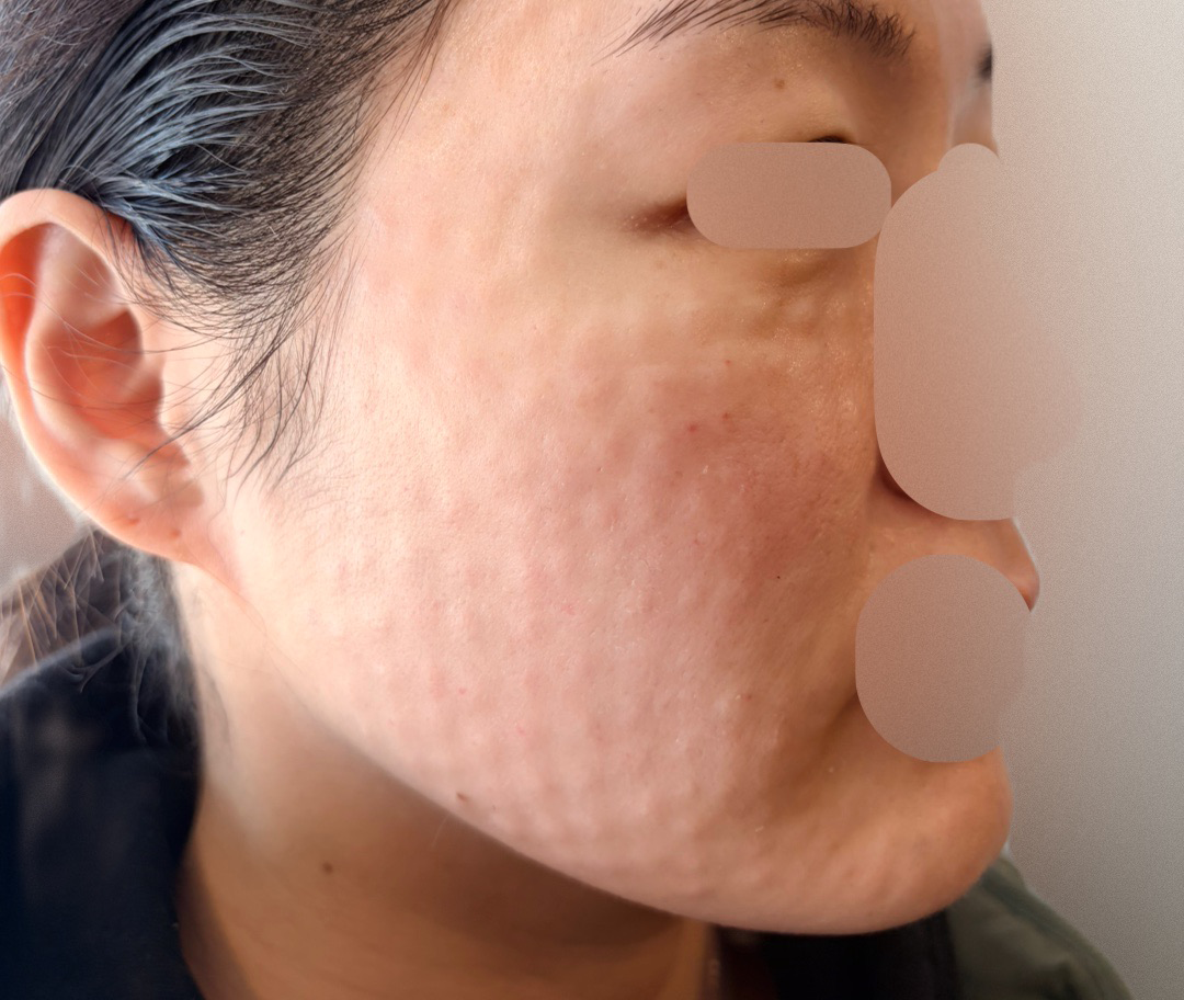 수술후기이미지