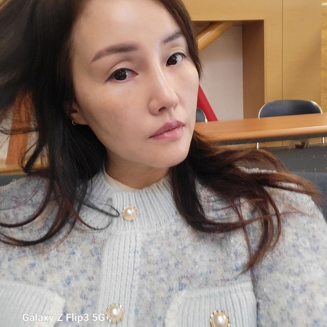 수술후기이미지