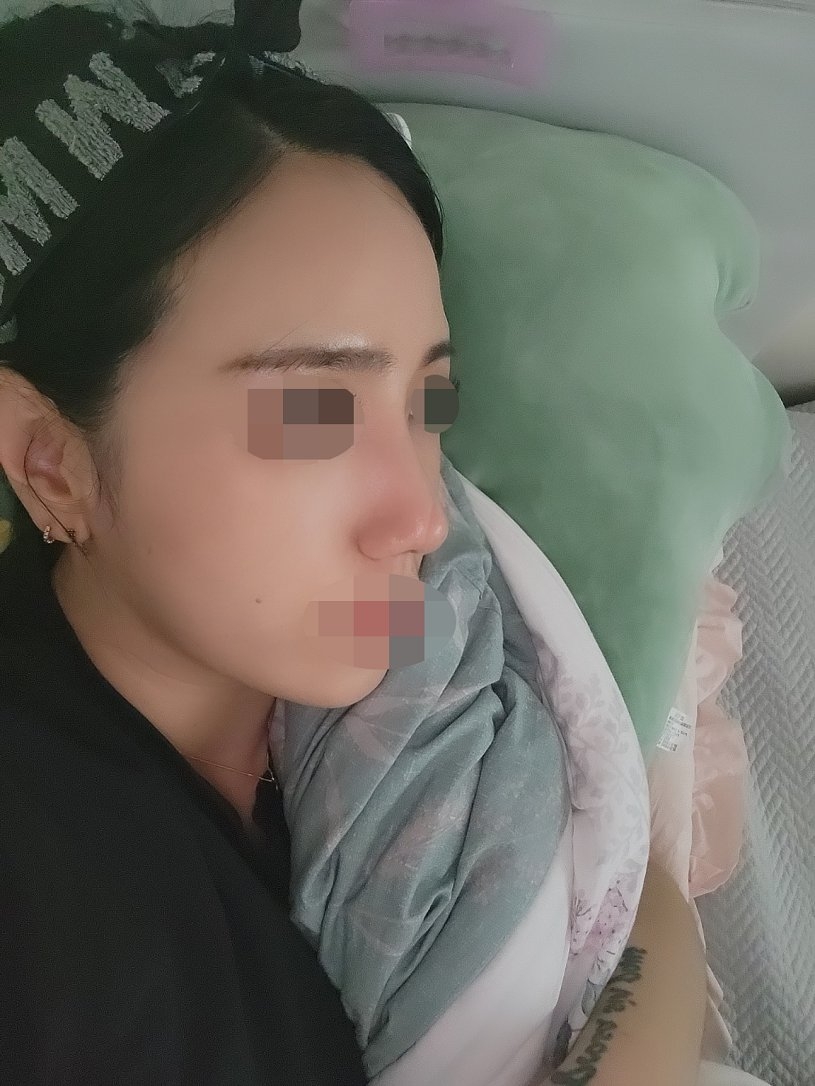 수술후기이미지