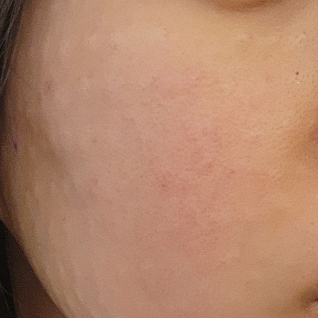 수술후기이미지