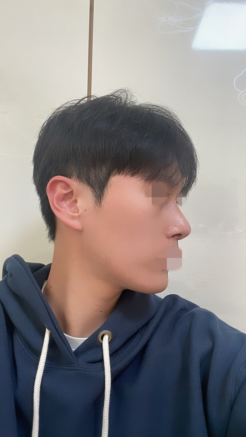 수술후기이미지