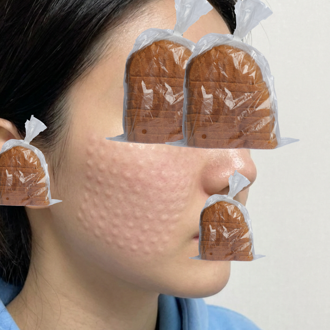 수술후기이미지