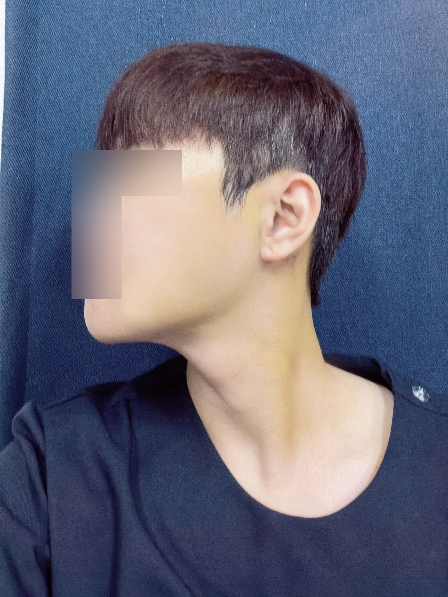 수술후기이미지