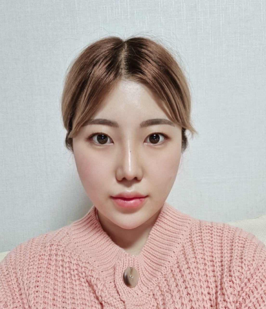 수술후기이미지