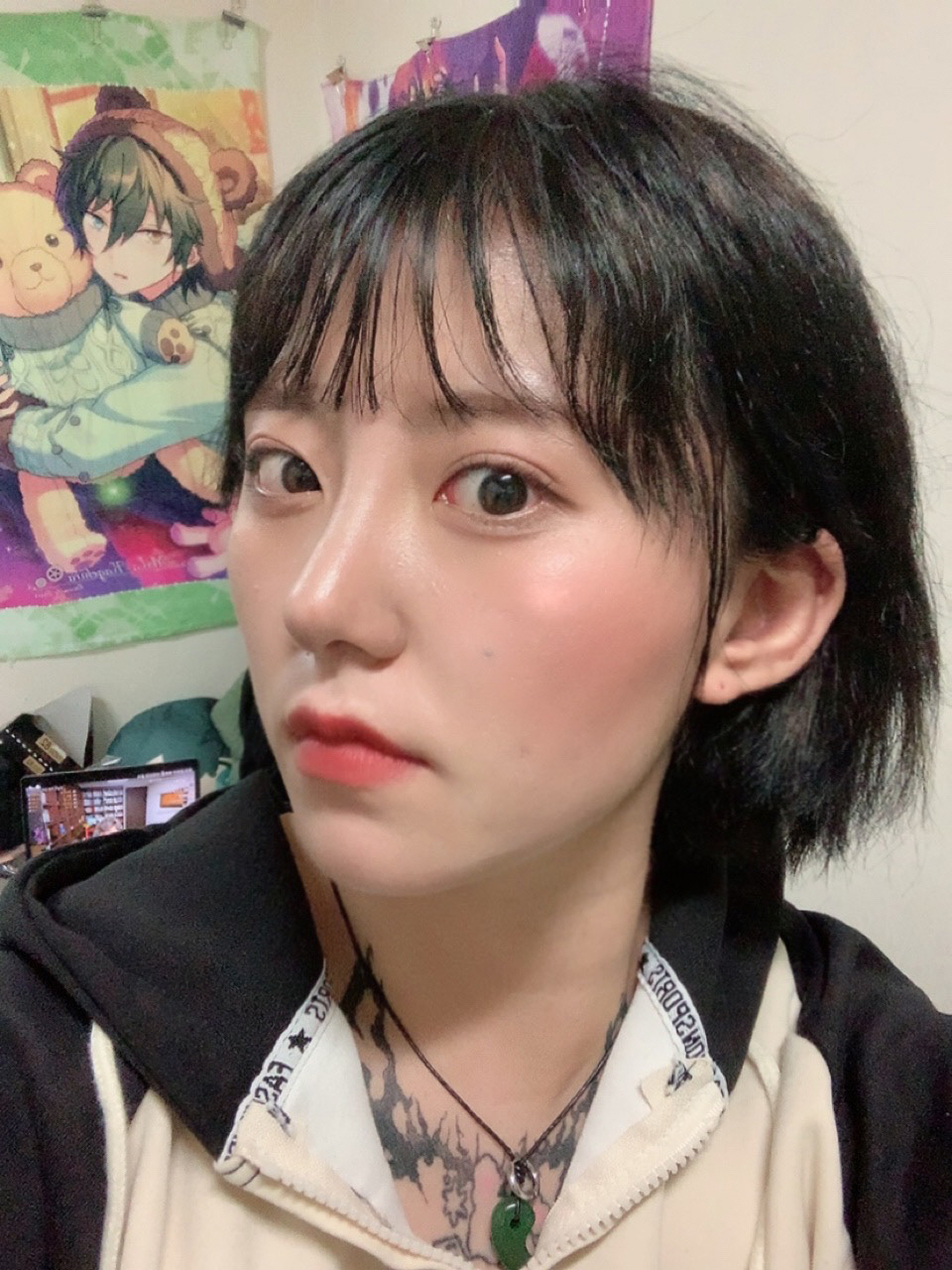 수술후기이미지