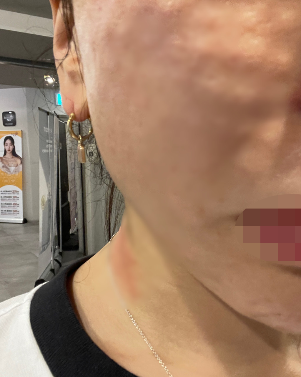 수술후기이미지
