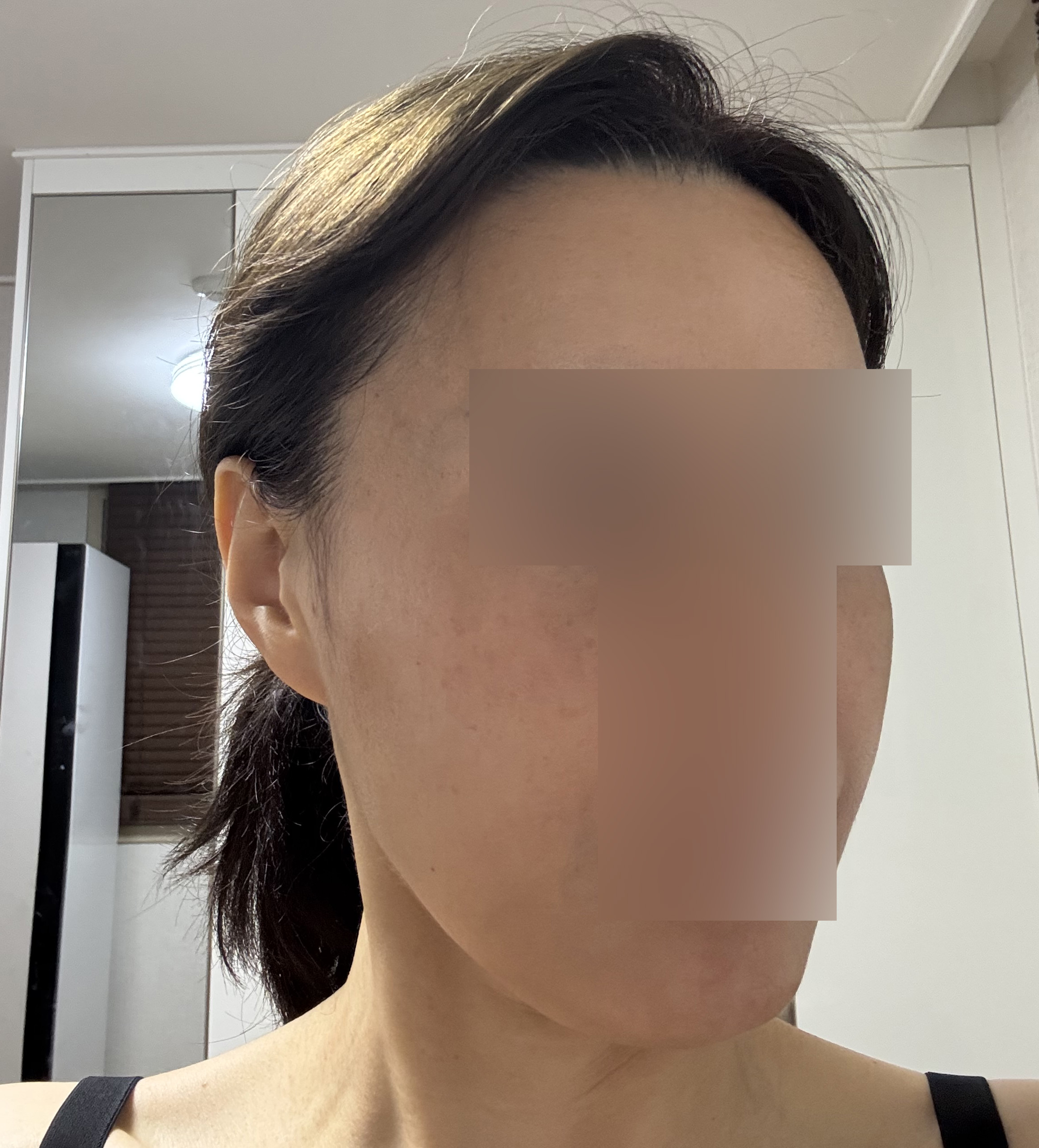 수술후기이미지