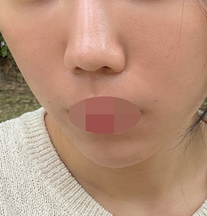 수술후기이미지
