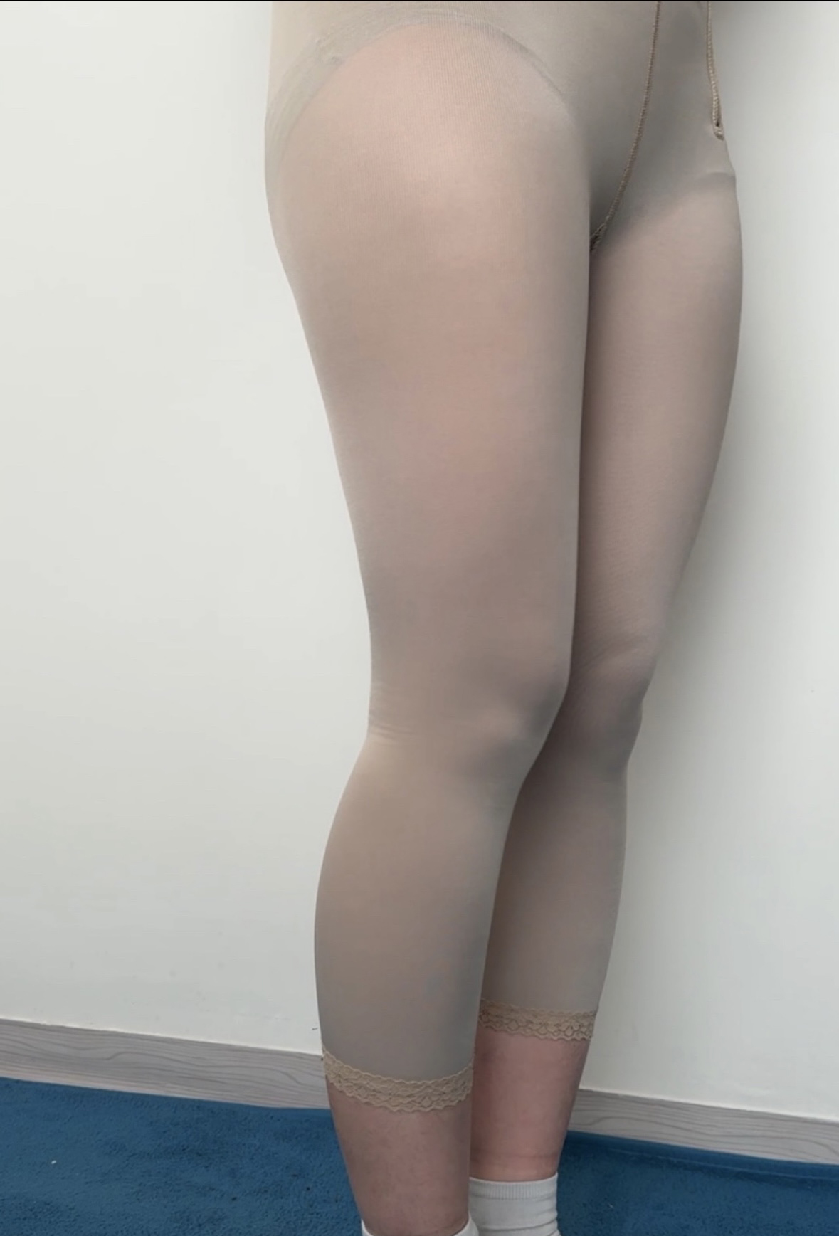 수술후기이미지