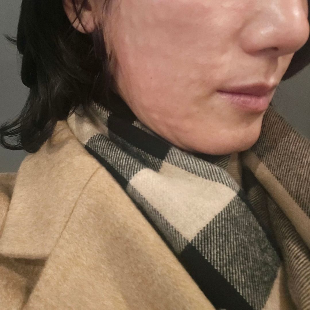 수술후기이미지