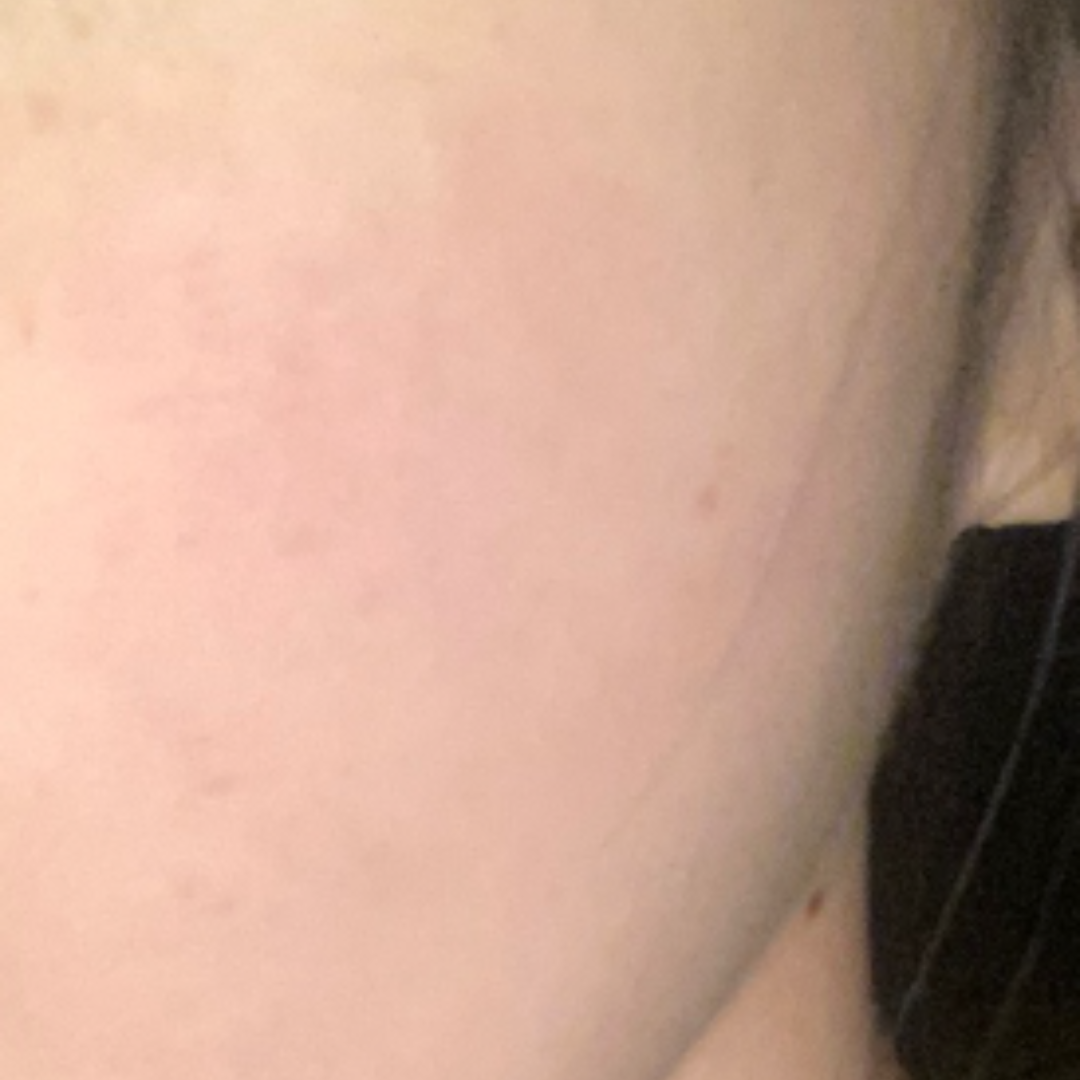 수술후기이미지