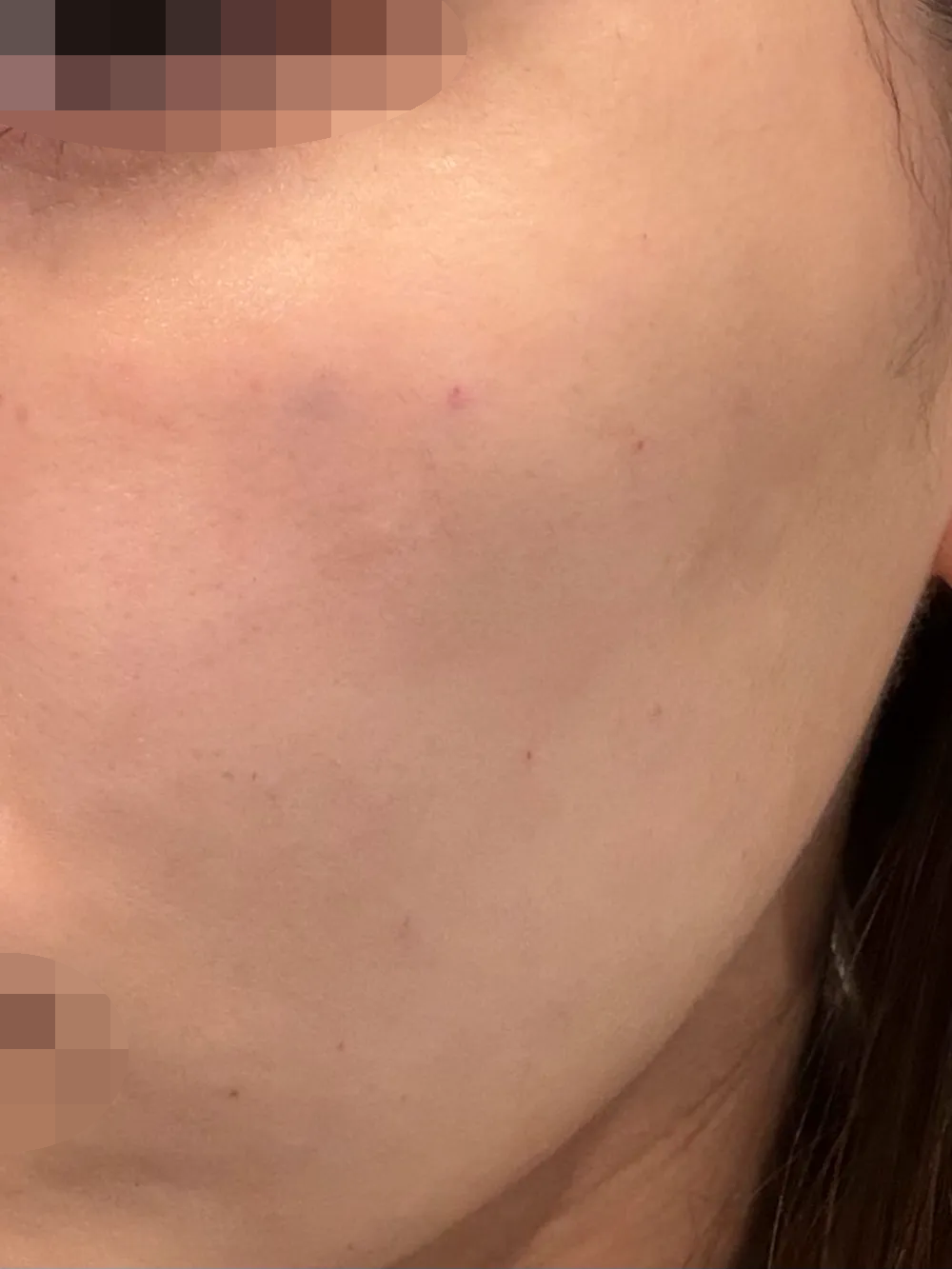 수술후기이미지