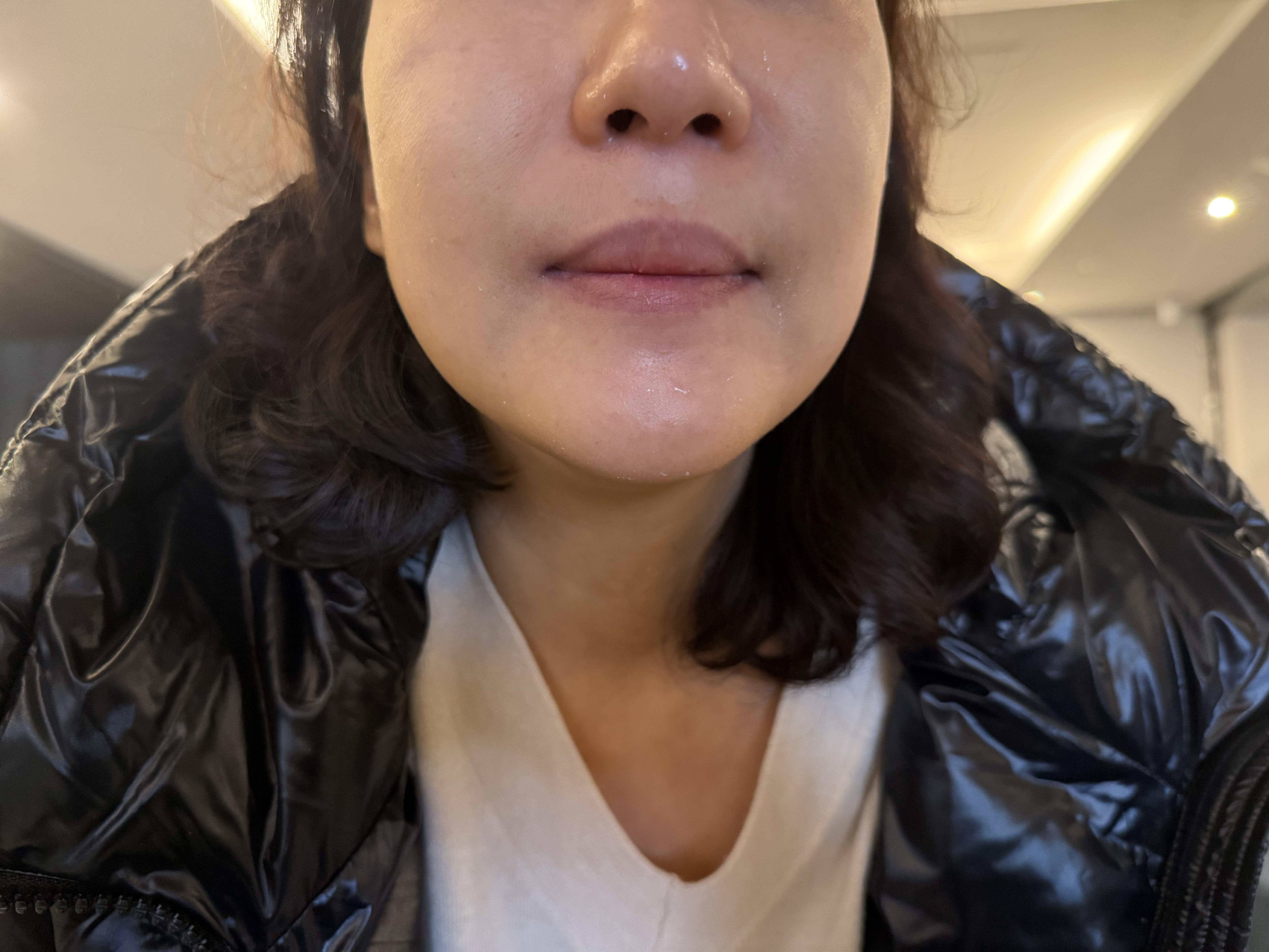 수술후기이미지