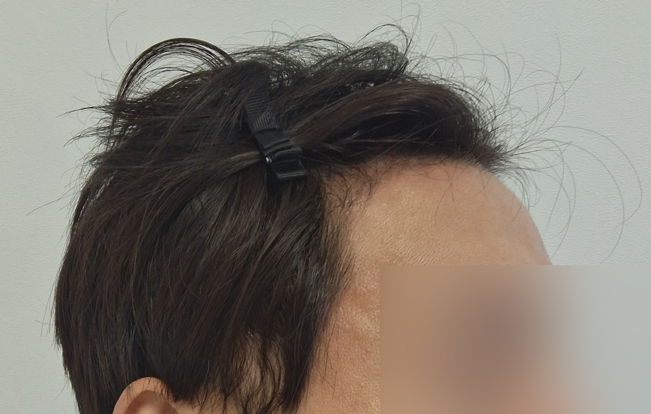 수술후기이미지