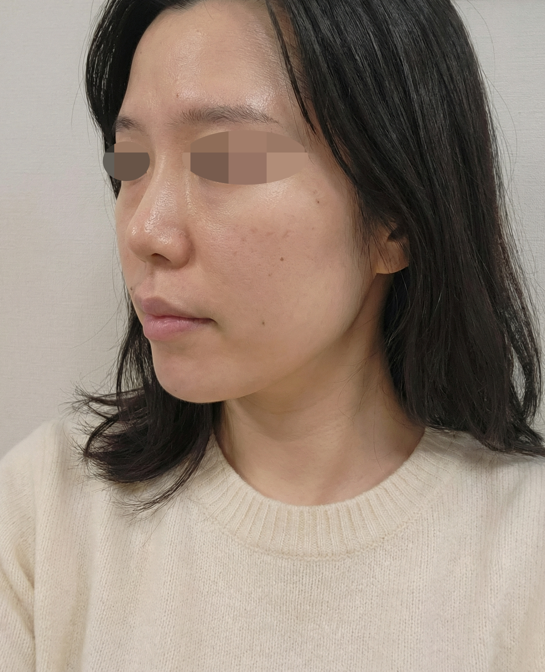 수술후기이미지