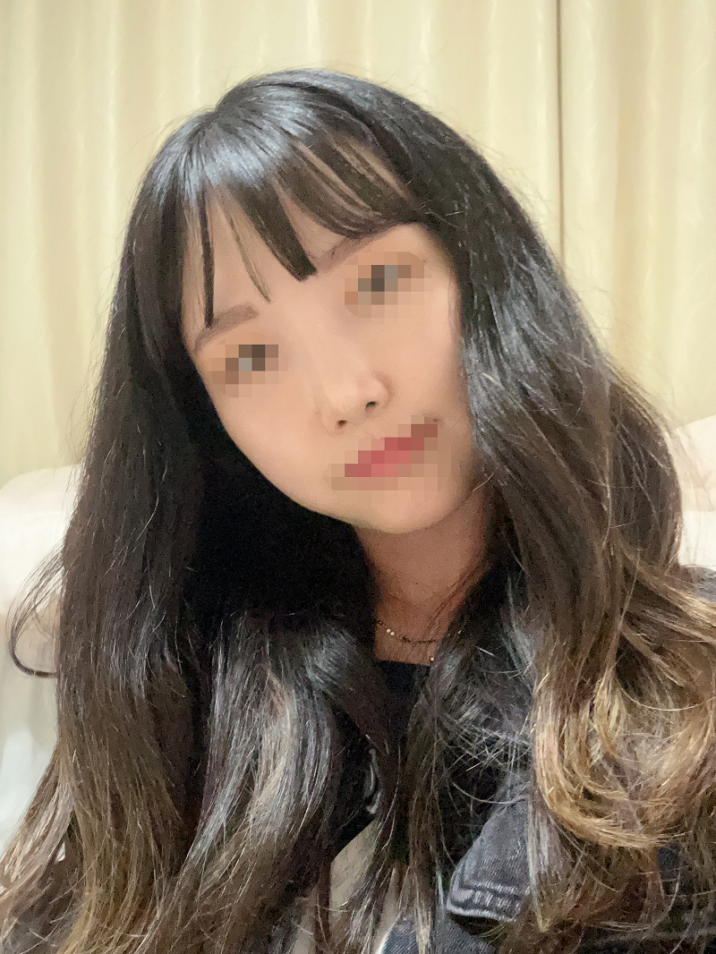 수술후기이미지