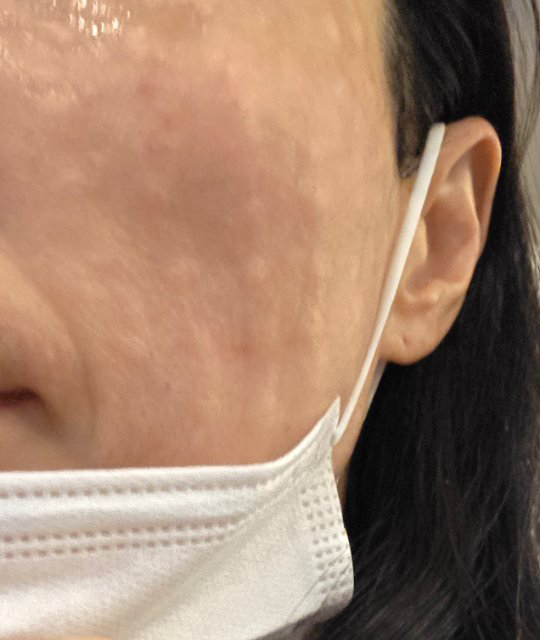수술후기이미지
