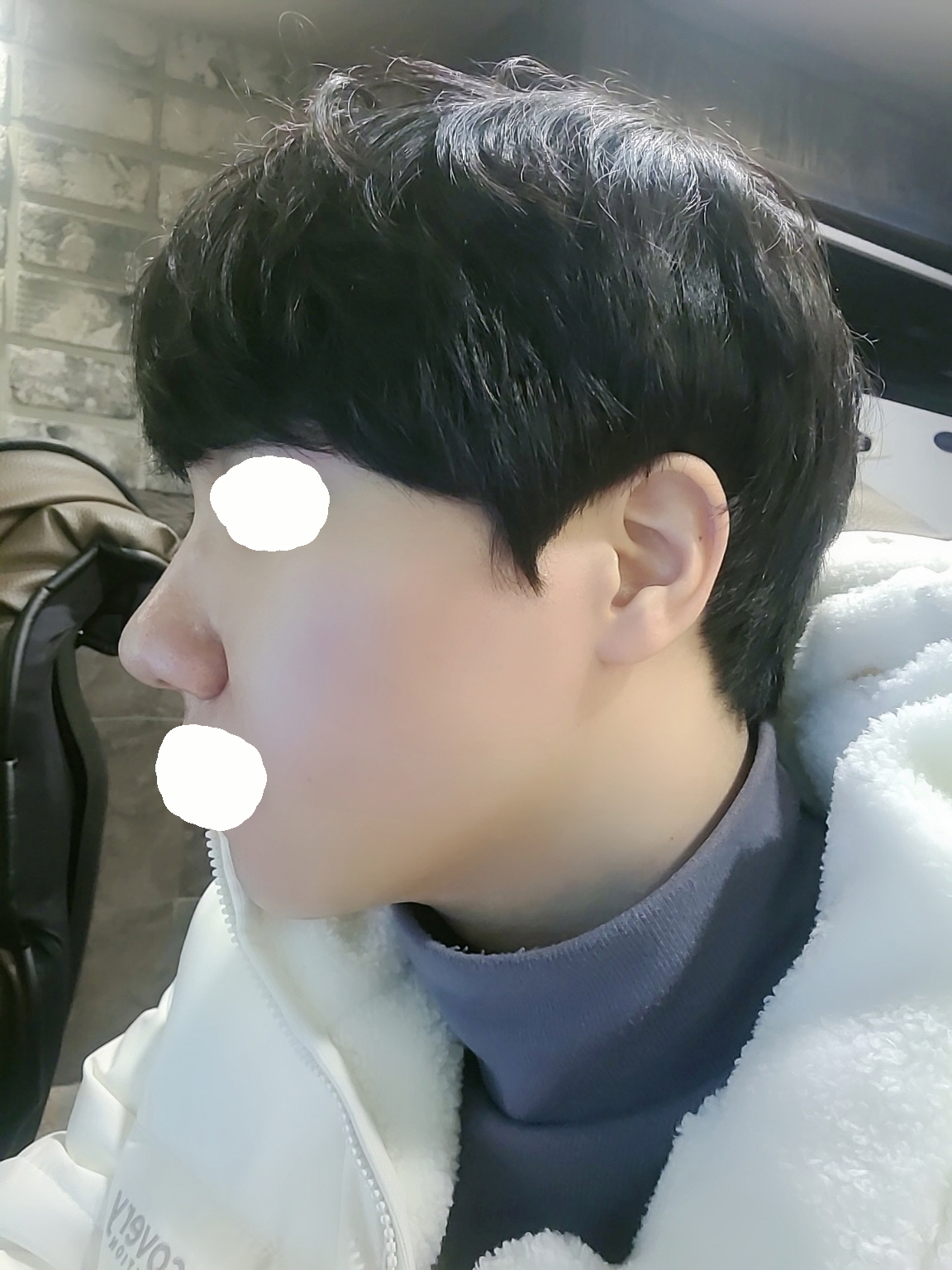 수술후기이미지