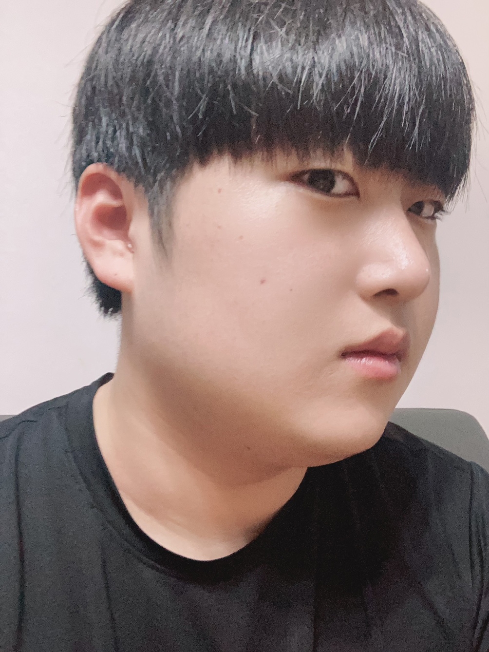 수술후기이미지