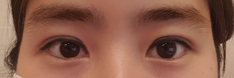 수술후기이미지