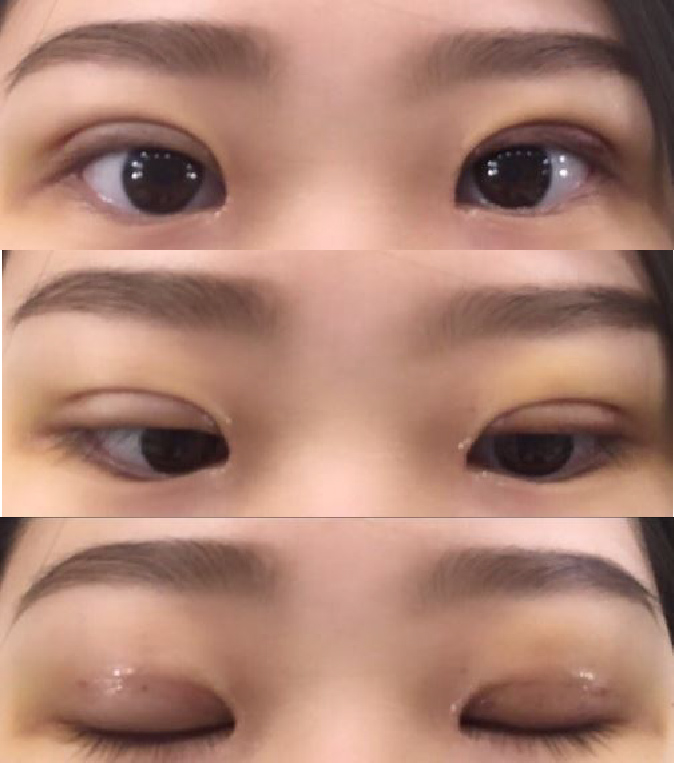 수술후기이미지