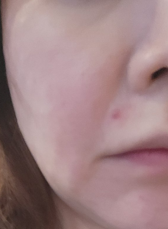 수술후기이미지