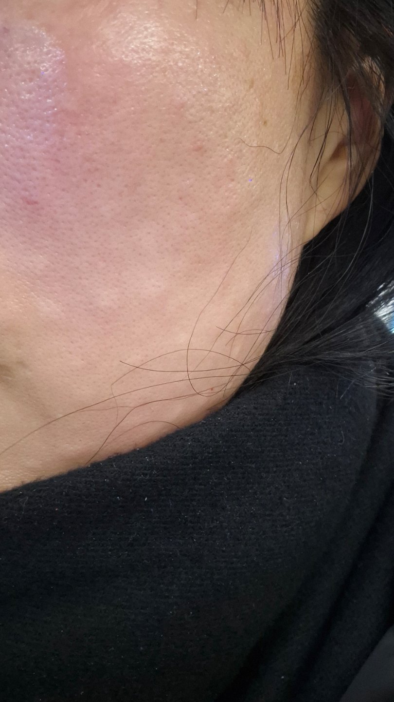 수술후기이미지