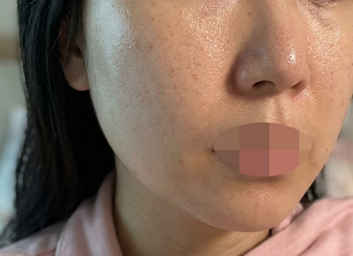 수술후기이미지