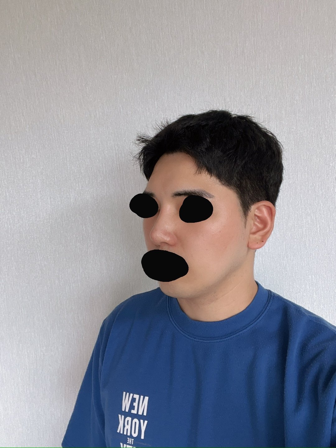 수술후기이미지